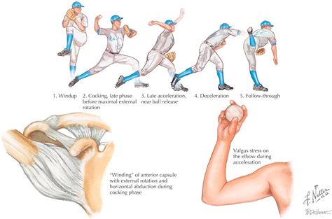 Baseball - Clinical Tree