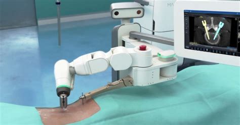 Global Surgical Robots Market Growth Projection to 2024 — Teletype