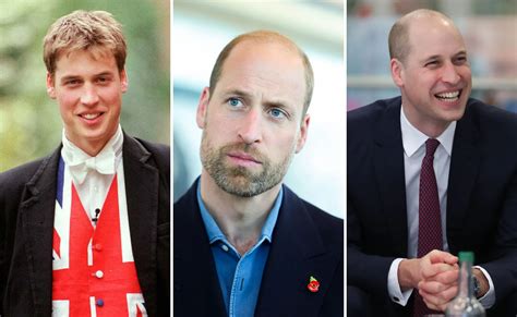 Prince William hair evolution | Now To Love
