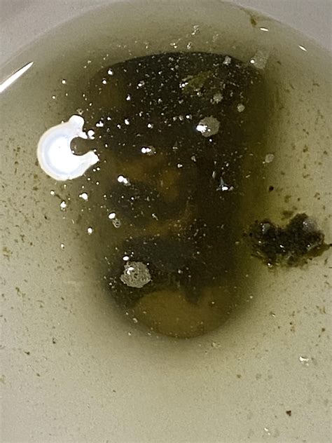 Is this coffee ground poop : r/poop