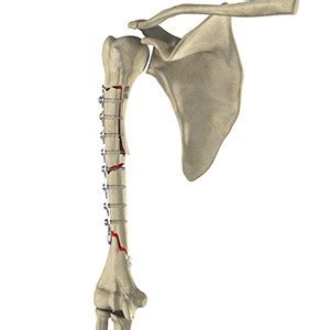 Image result for Complex Repair