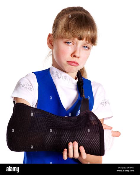 Broken arm in a cast. Isolated Stock Photo - Alamy