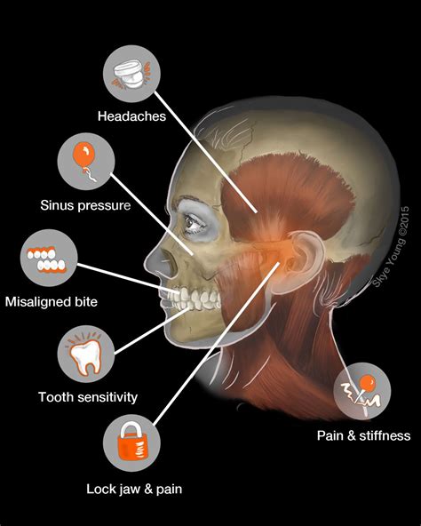 Tooth Infection Pressure In Head at Marvin Wolbert blog