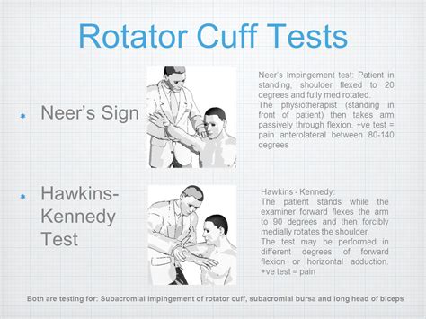 Rotator Cuff Muscles Test 的图像结果