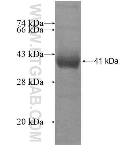 TBC1D16 Fusion Protein Ag11260 | Proteintech