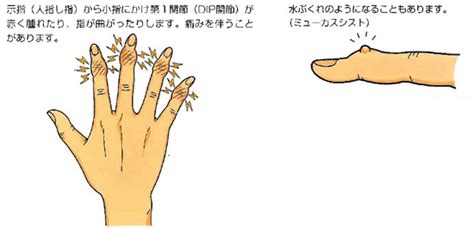 Image result for Volume Mass Problem