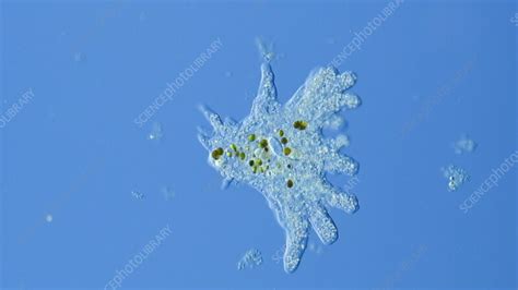Image result for Amoeba Microscopy