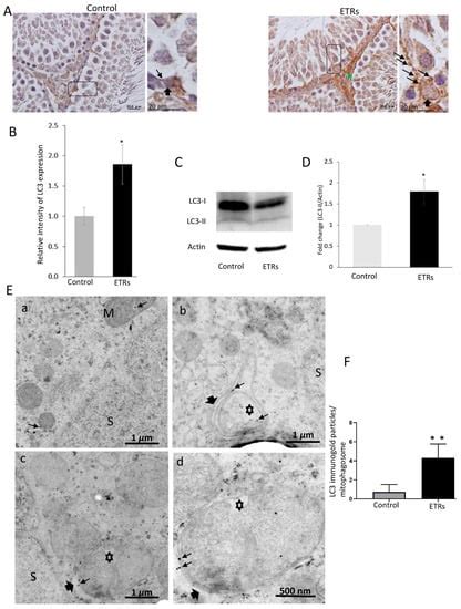 Ethanol-Induced Mitochondrial Damage in Sertoli Cells is Associated ...