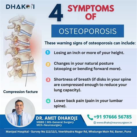 Know the Signs of Osteoporosis! 1️⃣ Height Loss: Are you shrinking? Losing an inch or more of ...