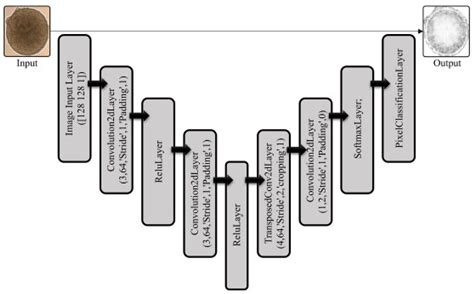 Enhanced U-Net-Based Deep Learning Model for Automated Segmentation of ...