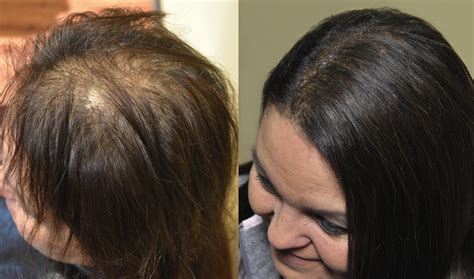 How To Thin Hair On Top - POPULAR MEN'S HAIRCUTS