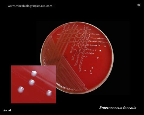 Image result for Enterococcus Faecalis MSA Plate