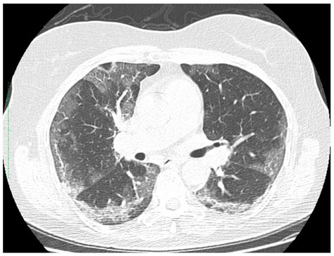 Safe, Smart, and Scalable: A Prospective Multicenter Study on Low-Dose ...