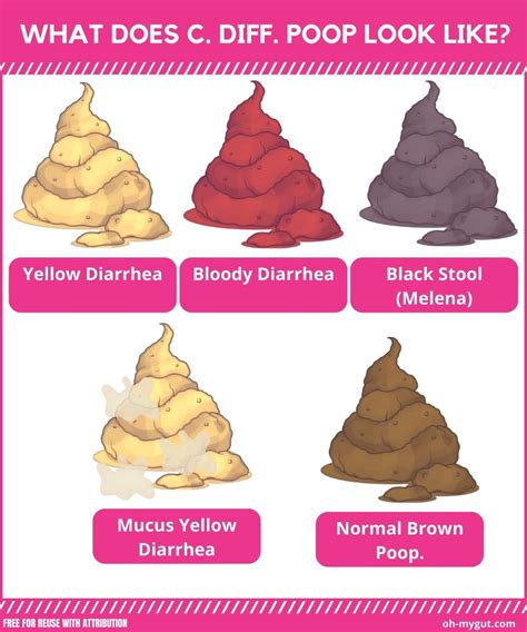 What Color Is C Diff Poop 的图像结果