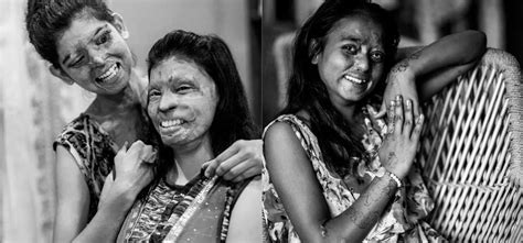 These-Stunning-Portraits-Of-Acid-Attack-Survivors-In-India-Show-What-A ...