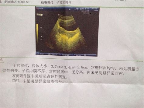 孕31周，b超显示胎儿sd值增高，是什么意思？_今天做检查，_宝宝树