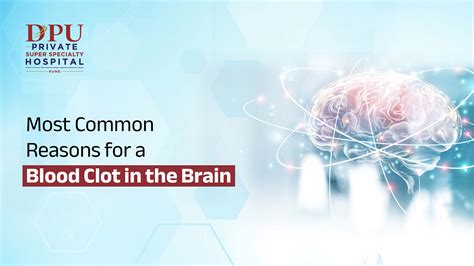 Understanding Common Causes of Brain Blood Clots