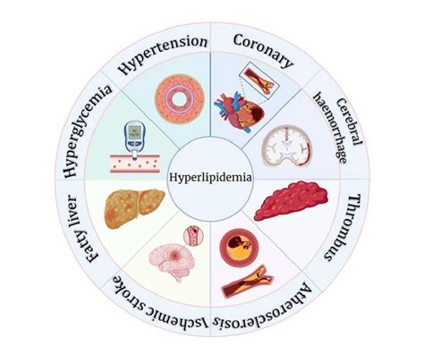 Complications of hyperlipidemia (HLP). | Download Scientific Diagram