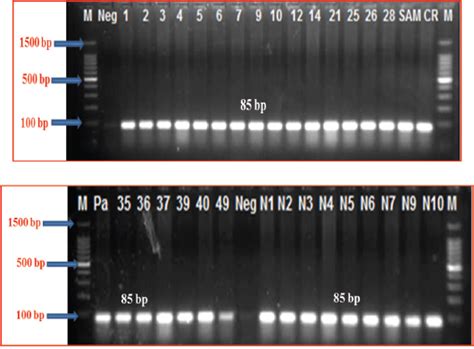 Detection of virulence genes and investigation of the immunogenicity of ...