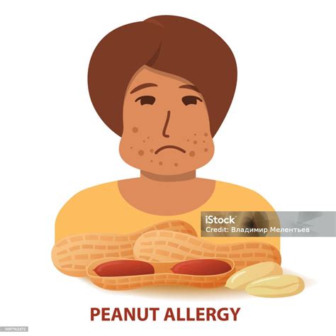 Nut Allergy Symptoms Problem Swollen Man Character Stock Illustration - Download Image Now - iStock