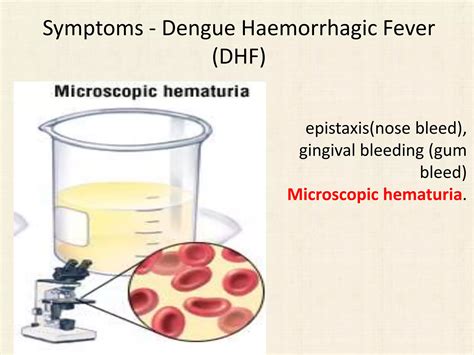 Dengue and Dengue Hemorrhagic Fever | PPTX - treatment for dengue hemorrhagic fever