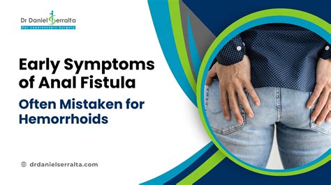 A Complete Recovery Guide On Stages Of Fissure Healing