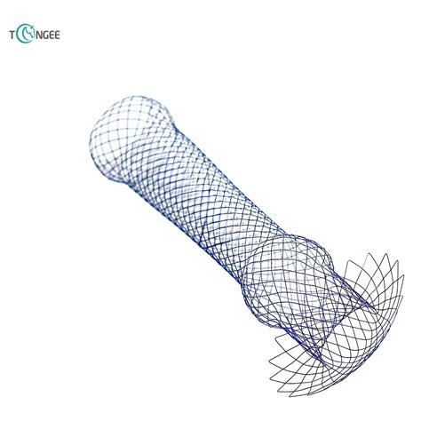 What are the different types of esophageal stents?