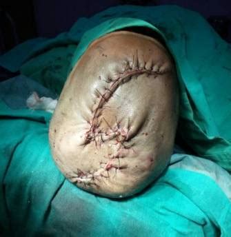 Oncology