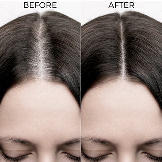 Brillare Rosemary Hair Growth Oil with Rosemary Shampoo | For Faster ...