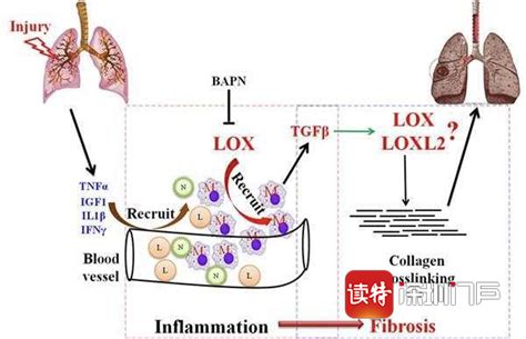 深圳市天佑医学研究院专家研究发现 TGF-b活性升高是新冠肺炎的发病机理_读特新闻客户端