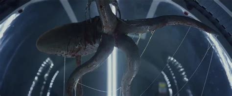 Image result for Prometheus Surgery Machine