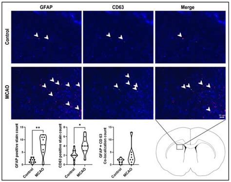 Endogenous Extracellular Vesicles Participate in Brain Remodeling after ...