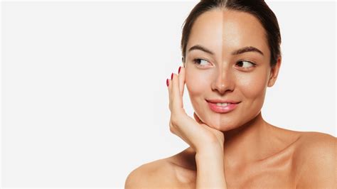 How to Remove Tan From Face: Tips for Brighter, Even Skin