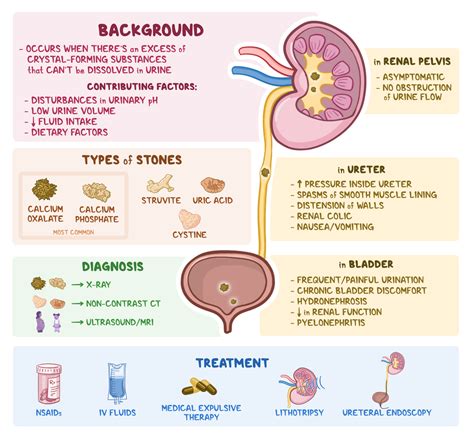 Osmosis - Nephrolithiasis: What Is It, Types, Signs and Symptoms ...