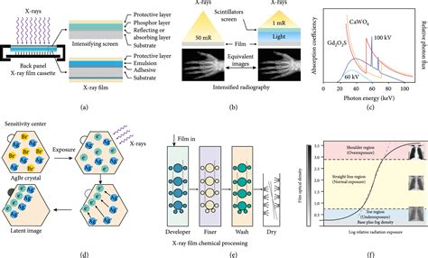 Inside The Layers Of An Xray Cassette: A Technical Breakdown