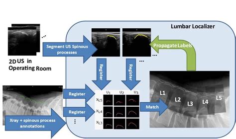 Image result for Deflection of Localizer