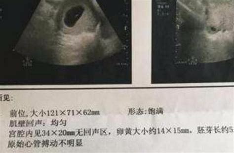 在这个孕周，胎儿容易出现缺氧的情况，准妈妈要注意