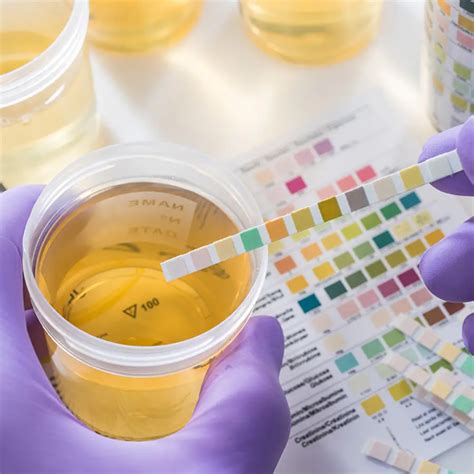 Proteinuria: A Predictor of Sudden Cardiac Arrest in the Young?