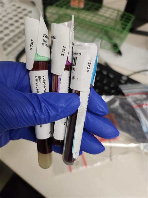 Image result for Lab MLT