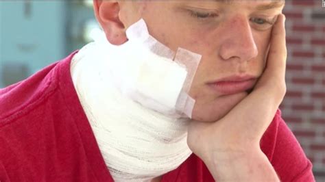 Electric Cigarettes Exploding in Pockets 的图像结果