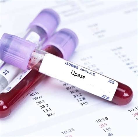 Understanding Lipase: Function, Test, and Pancreatic Health – MyDiagnostics