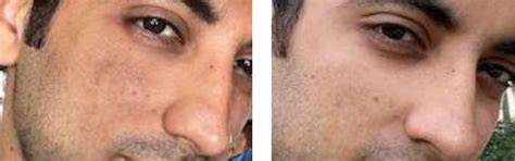 Mineral Sunscreen for Oily, Combination & Sensitive Skin – Oleum Cottage