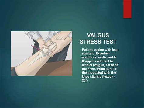 Special Tests Of Knee Joint | PPTX