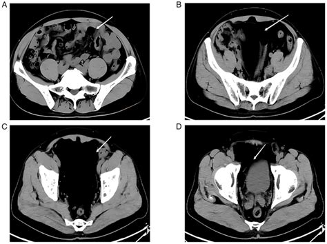 Experimental and Therapeutic Medicine