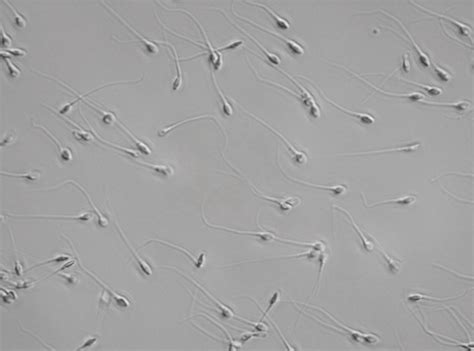 ABNORMAL SPERM MORPHOLOGY - NatureHill