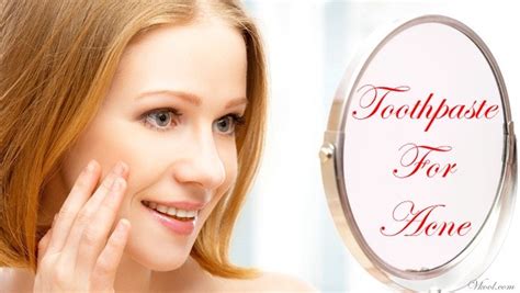 Image result for Toothpaste Causing Acne