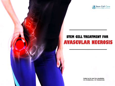 Avascular Necrosis Injury Treatment – ARJF