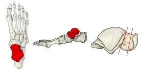 Image result for Scan List for Items Python