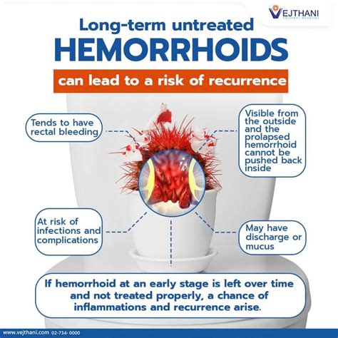 Internal Hemorrhoids Vs Piles at Jorja Helms blog