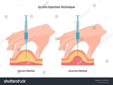 Insulin Injection Explained at Kiara Vaux blog